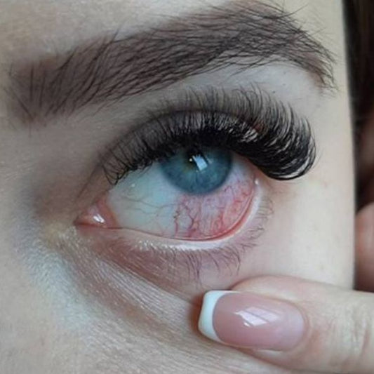 rotes gereiztes Auge Wimpernverlängerung